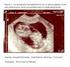 Ultrasonido en el primer trimestre del embarazo 10 consideraciones básicas