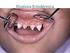 Anomalías y displasias dentarias de origen genético-hereditario