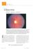 Glaucoma Patogenia, diagnóstico y tratamiento