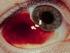Infecciones y trauma ocular
