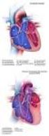 CASO CLÍNICO. Hipoplasia de cavidades izquierdas en un feto. Left heart hypoplasia in a fetus