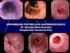 Tratamiento, complicaciones y seguimiento de la esofagitis eosinofílica