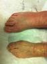 El pie en reumatología