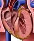 Insuficiencia cardiaca diastólica