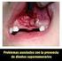 Problemas asociados con la presencia de dientes supernumerarios - Reporte de un caso