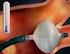 El Aislamiento de las Venas Pulmonares como Tratamiento de la Fibrilación Auricular Refractaria