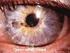 Urgencias oftalmológicas