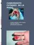 Referencias anatómicas para la tenolisis percutánea de los flexores de la mano