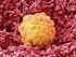 Qué es el fallo de implantación embrionaria?
