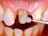 Adhesión a tejidos dentarios 1 2 1