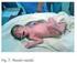 Curvas de crecimiento intrauterino de recién nacidos madrileños: peso, talla y perímetro cefálico