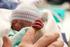 Talla, peso y perimetro craneano segun edad gestacional en recien nacidos de menos de 35 semanas