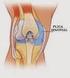 Patología sinovial de la rodilla: Diagnóstico diferencial por RM