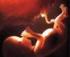 La muerte fetal es una de las situaciones más. Muerte fetal: realidad en Chile entre