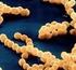 Vigilancia de laboratorio enfermedad invasora Streptococcus agalactiae