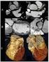 Tomografía de 64 cortes, una nueva aproximación al diagnóstico de enfermedad coronaria