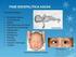Caracterización clínica y serológica de la toxoplasmosis ocular activa