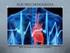 Displasia ventricular derecha arritmogénica (DVDA) Pruebas genéticas para arritmias/miocardiopatías heredadas. guía para el paciente