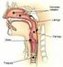 Parálisis de las cuerdas vocales tras cirugía de la aorta torácica descendente a través de una toracotomía posterolateral