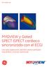 MYOVIEW y Gated SPECT (SPECT cardiaco sincronizado con el ECG)