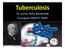 Tuberculosis+ Dr.+Carlos+Peña+Man4ne5+ Encargado+PROCET+SSMC+