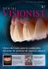 VISIONIST DENTAL 2.7. Claves del éxito para la confección eficiente de prótesis de aspecto natural