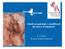 Estudi prequirúrgic i estadificació del càncer d'endometri. E. Cayuela Hospital General Hospitalet