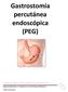 Gastrostomía percutánea endoscópica (PEG)