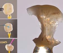 Odontología Endodoncia Implantes Ortodoncia