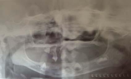 La evaluación odontológica, por radiografía y ortopantomografía a los 22 meses, reveló