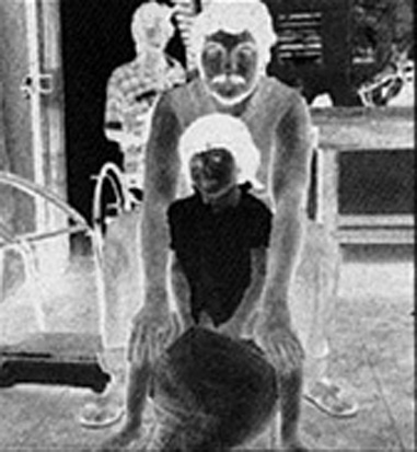 98 CAPÍTULO 9 EL NIÑO CAMPESINO DESHABILITADO (1996) Si al niño se le abren las piernas, le saltan las nalgas y se le van los hombros hacia atrás, primero siéntelo con el cuerpo doblado hacia
