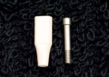 Los materiales de Dentona: dento-mask 21 y Dreve: GumQuick implant se distinguen por su excelente escaneabilidad en el escáner Cercon eye.