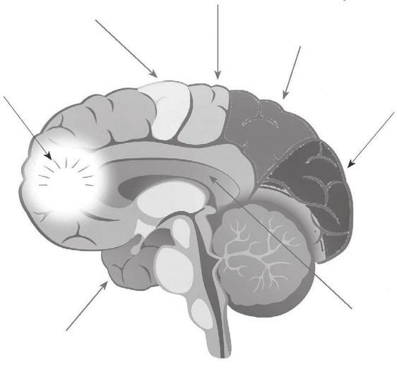 (Visión del entorno) Mesencéfalo (Emociones) Lóbulo temporal Centro asociativo (Identidad) Figura 5c.