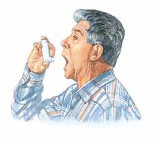 Es posible que le indiquen que use un espaciador (tubo de retención) con su inhalador para asegurar que en los pulmones le entre toda la dosis del medicamento que usted necesita.