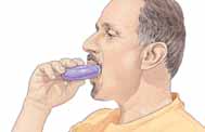 Cuándo debe reemplazar su inhalador de dosis medida Cada inhalador contiene solo una cierta cantidad de medicamento.