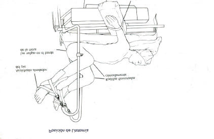 Se recomienda poner apoya pie para prevenir el deslizamiento del paciente hacia abajo. Las abrazaderas de seguridad de piernas y brazos deben estar en posición correcta.