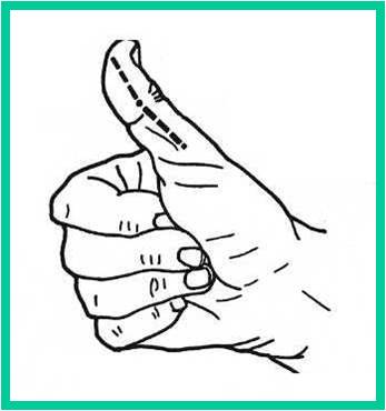metacarpofalángicas de los cuatro últimos dedos, por las mismas razones no debe inmovilizarse esta articulación en extensión (riesgo de retracción y rigidez).
