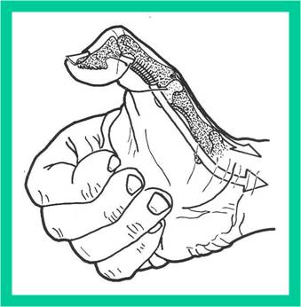 -5- Acción: extiende la interfalángica y pasivamente lleva el metacarpiano y la falange proximal hacia adentro y atrás ( aduce y extiende), contribuyendo a aplanar la palma de la mano (el pulpejo