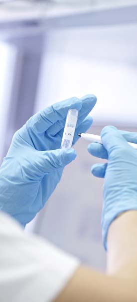 Garantías de calidad Una vez que el jefe de laboratorio y de control de calidad confirmen la idoneidad de la sangre, les enviaremos el Certificado de Almacenamiento y los resultados de las pruebas.