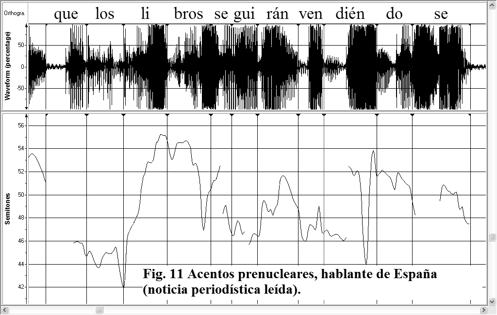 Acentos prenucleares: evidencia sobre el español 27 de Barcelona y Alicante; de manera similar, Toledo (en prensa b; 2006 a) registra acentos prenucleares con posrealización del tono (bajo el umbral