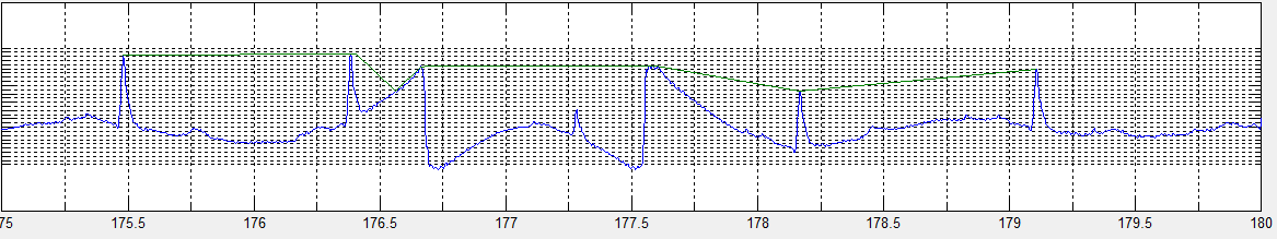 Figura 4.1. Ejemplo de falso positivos. Las grandes perturbaciones de la señal afectan la fiabilidad de los algoritmos 4.