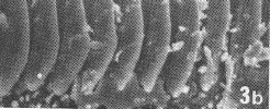 La estridulación en el grillo Alas anteriores Espacio subalar Plectrum o rascador Fila de dientes Rascador 9 Estructura de las filas de dientes del ala de distintos grylloidae Mogoplistinae: