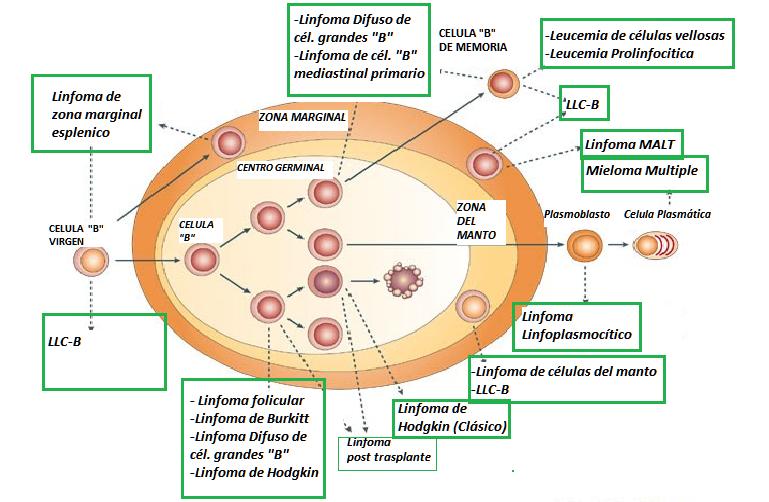 10 4. 5. Figura 6. Origen de distintos tipos de linfomas B a nivel del ganglio linfático. 4. Clasificación de los Síndromes Linfoproliferativos Crónicos Los SLPC engloban a los linfomas no Hodgkin y al linfoma de Hodgkin.