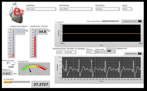 Monitor Preacondicionamiento de señales Adquisición de señales Panel frontal Procesamiento de la señal digital. Etapa de Instrumentación virtual Figura 1.