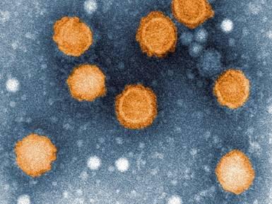 Chikungunya: el virus http://www.google.com/imgres?
