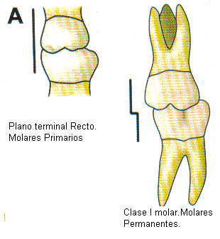 Disminución D del Perímetro del Arco 13 El segundo molar primario inferior habitualmente es algo más ancho mesiodistalmente que el superior originando típicamente un plano terminal recto al final de