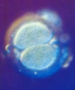 TEMA : DESARROLLO PRENATAL Una nueva vida comienza La fecundación El óvulo posee una membrana celular exterior que lo protege y que puede ser atravesada por más de un espermatozoide a la vez.