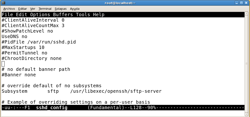 Imagen 14: Archivo de configuración del servicio SSH.