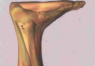 VEJIGA 60 KUEN LOUN: En el centro entre el maleolo externo y el tendon de