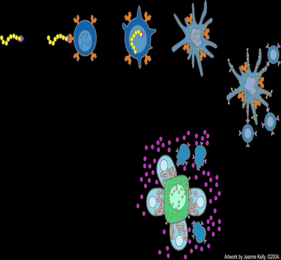 Ataque mediado por células dendríticas a la célula cancerosa Complejo unido a precursor de células dendríticas Antígeno tumoral unido a una citoquina El complejo es fagocitado por el precursor de